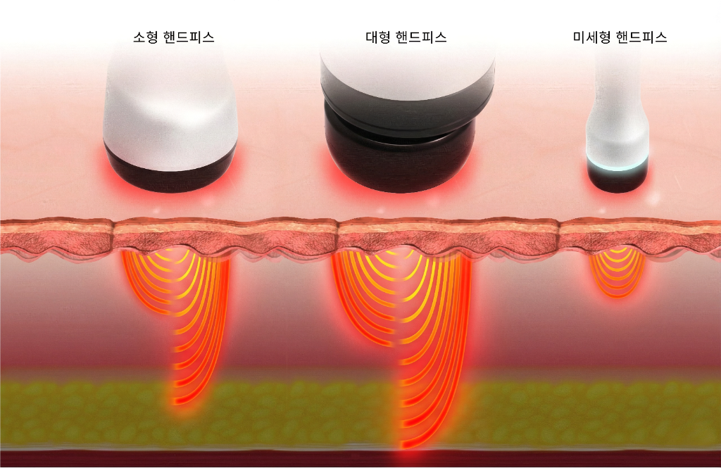 Toroidal RF Technology